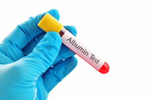 Định lượng Albumin là gì?