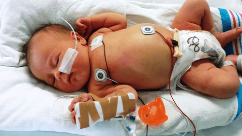 Prevention and care of infants with neonatal infections