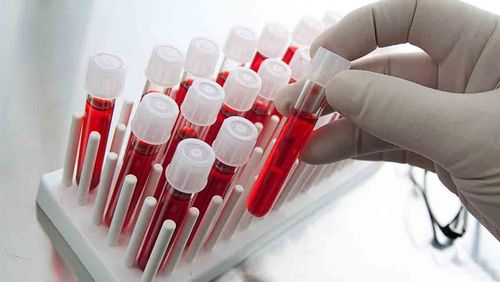 Find out information about blood calcium quantification