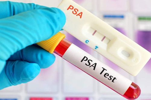 PSA test after prostatectomy