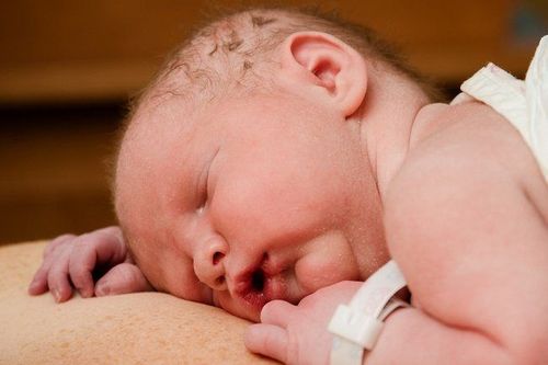 Signs of infant inhalation of meconium