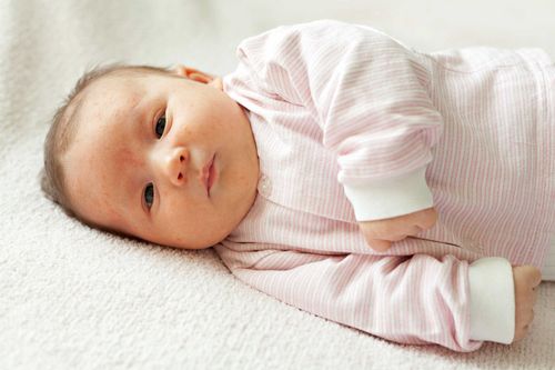 Signs of infant infection