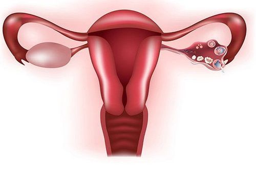 Possible complications of premature ovarian failure