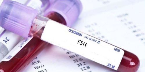 What is the normal level of FSH?