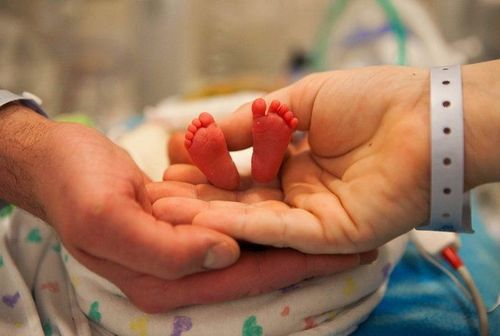 What is extremely preterm birth?