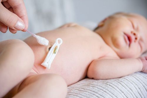 How to take care of the umbilical cord for babies