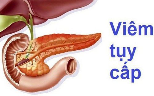 
Viêm tụy có thể gây viêm phúc mạc thứ phát
