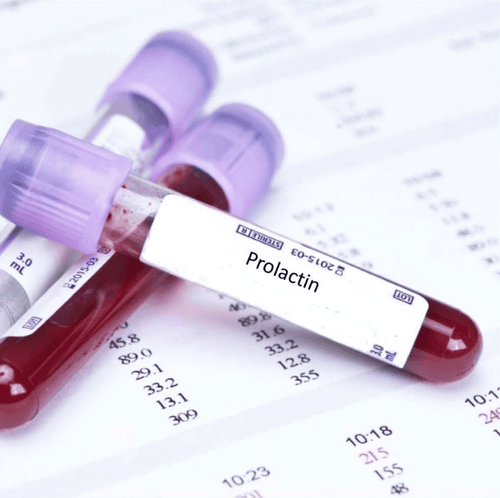 Causes of hyperprolactinemia