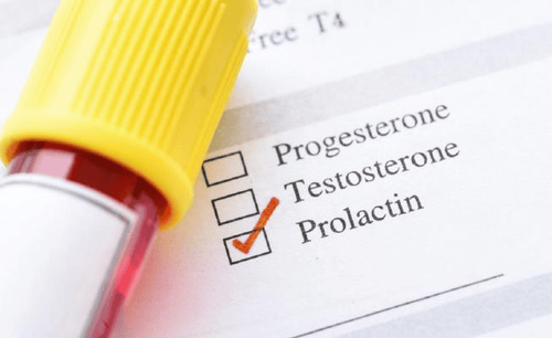 What does low prolactin mean?