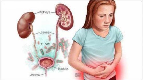 How to treat urinary tract infections in children?