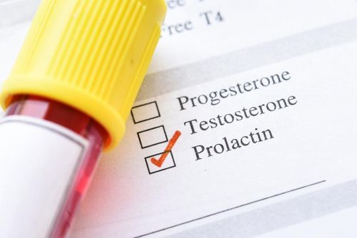 Kết quả xét nghiệm hormone prolactin nói lên điều gì?