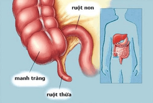 
Vị trí manh tràng trong ổ bụng
