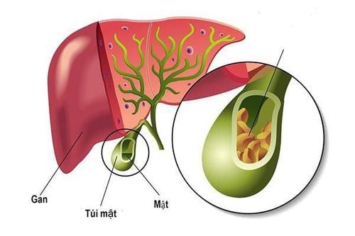 Why does the gallbladder collapse?