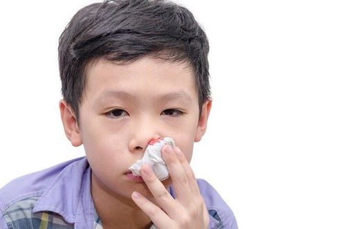 
Giai đoạn kịch phát có thể xuất hiện dấu hiệu chảy máu cam ở trẻ nhỏ
