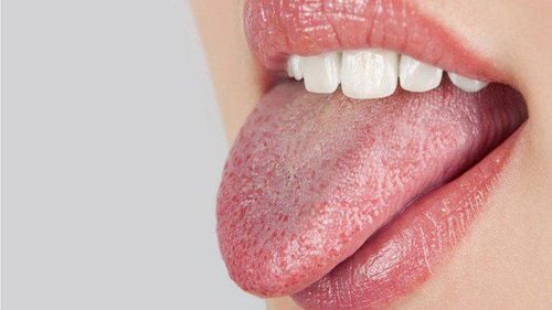 Dry mouth: Causes, symptoms and treatment