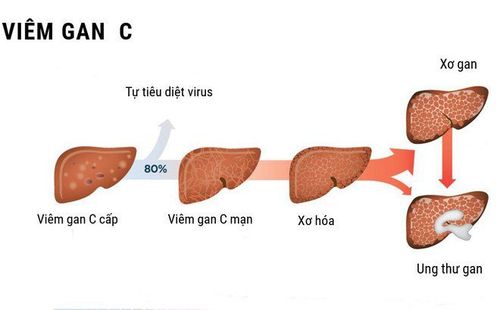 5 reasons you should get tested for hepatitis C