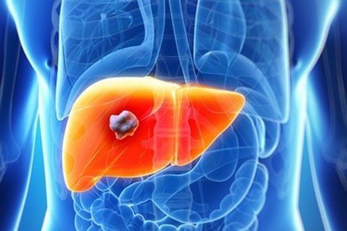 Why do liver abscesses need to be treated as soon as possible?