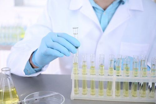 Indicators in the total urinalysis test