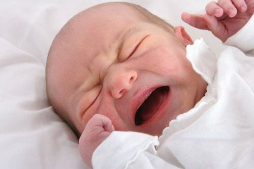 Signs of early neonatal infection