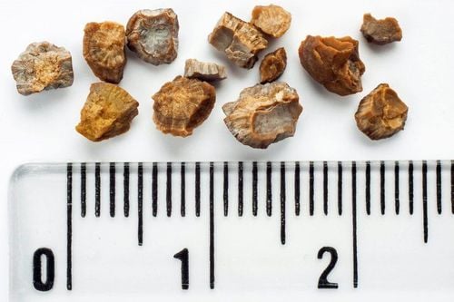 Kidney stones 6-7mm should take medicine or should surgery?