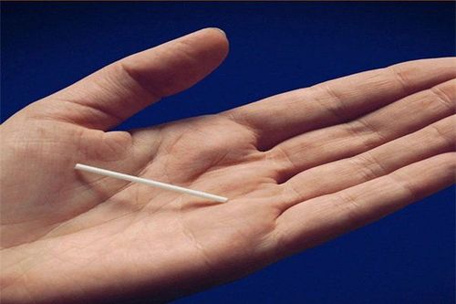 How long does the Implanon contraceptive implant last?