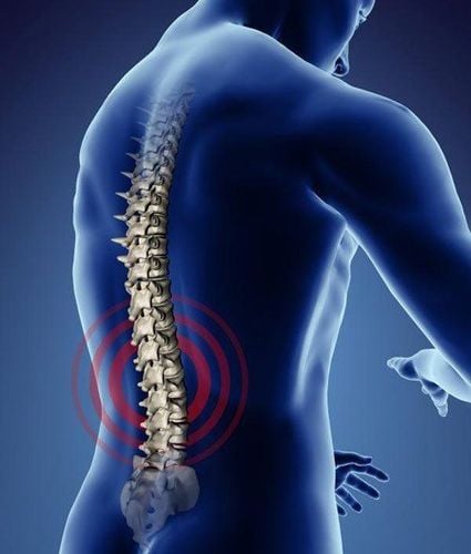 What can an X-ray of the spine show?