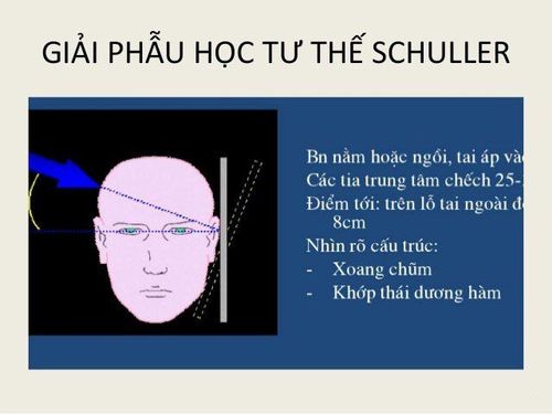 
Giải phẫu học tư thế Schuller
