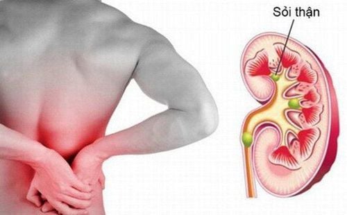 Methods of lithotripsy - urology