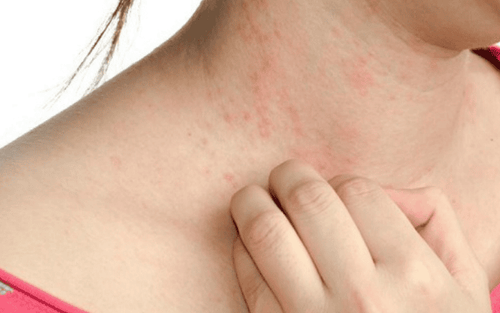 11 common causes of skin rashes