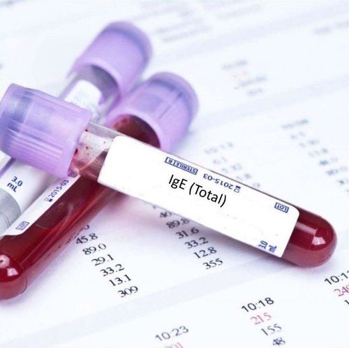 What is an IgE blood test?