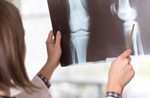Vai trò của X quang trong chẩn đoán bệnh lý khớp gối