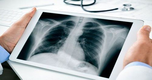 What is the effect of chest X-ray results in examination?