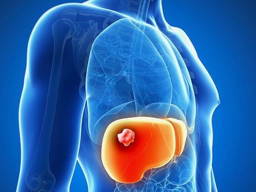 What is multifocal liver disease?