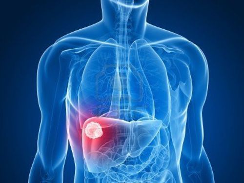 Hepatoblastoma: What you need to know