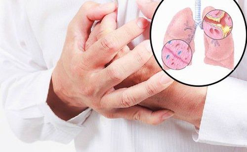 Nếu không điều trị kịp thời, viêm phế quản cấp có thể tiến triển thành viêm phế quản mãn tính