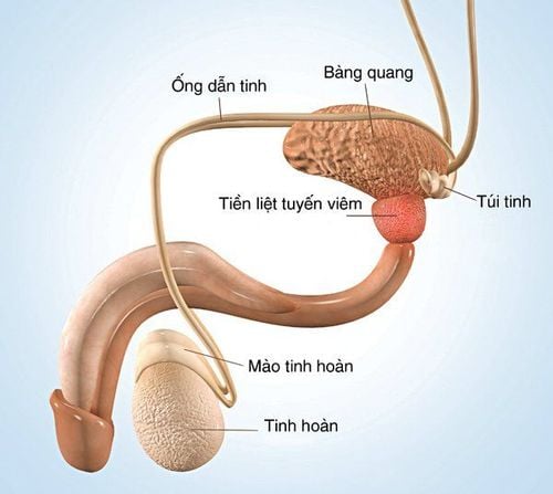 
Viêm tuyến tiền liệt gây tiểu ra máu
