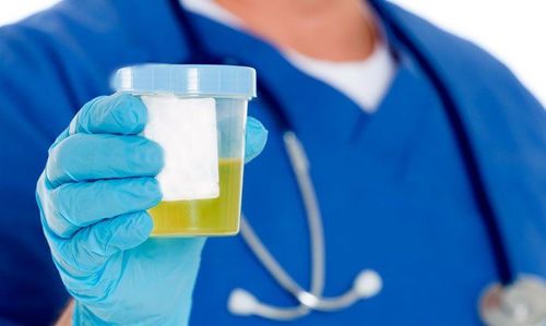 Why do urine tests have high white blood cells?