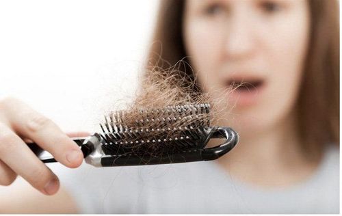Rụng tóc ở phụ nữ: Những điều cần biết