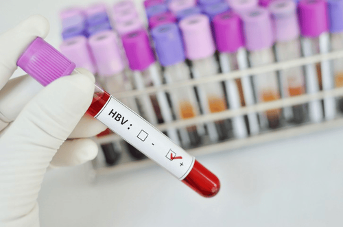 What to do if you test positive for hepatitis B virus?