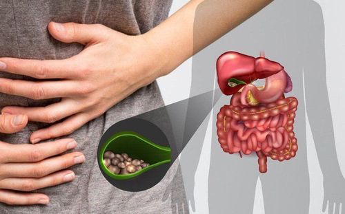 Complications and progression of gallstones