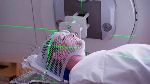 Instructional information: Caring for patients receiving radiation therapy in the head and neck area