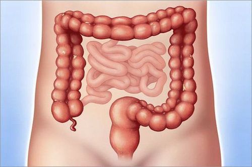 Learn about laparoscopic colon polyp removal