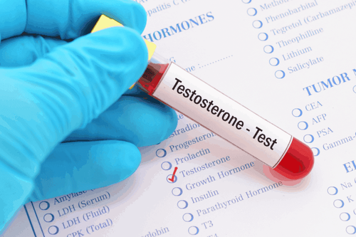 Nồng độ Testosterone thấp phải làm sao?