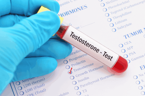 Male hypogonadism (reduced testosterone secretion) – How is it treated?