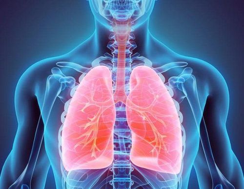 Viêm phổi mắc phải ở cộng đồng là gì?