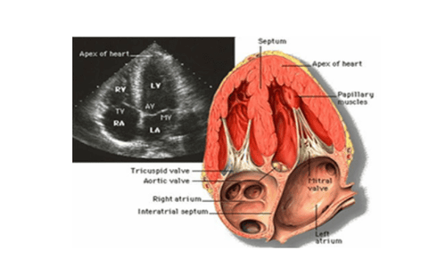 Có thể sử dụng phương pháp siêu âm tim để chẩn đoán bệnh viêm mạch