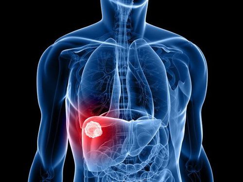 How is liver cancer treated?