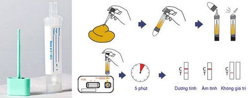 
Quy trình thực hiện xét nghiệm máu ẩn trong phân
