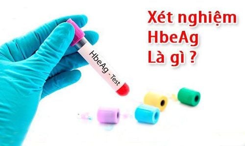 HBeAg test in the diagnosis of hepatitis B