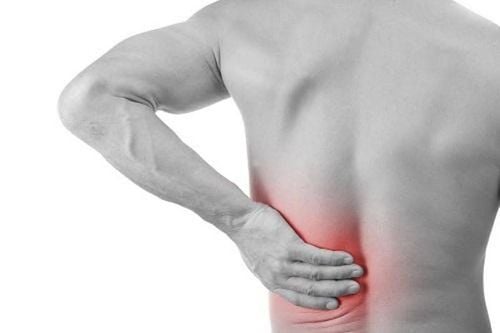 Giãn dây chằng, đau thắt lưng: Những điều cần biết